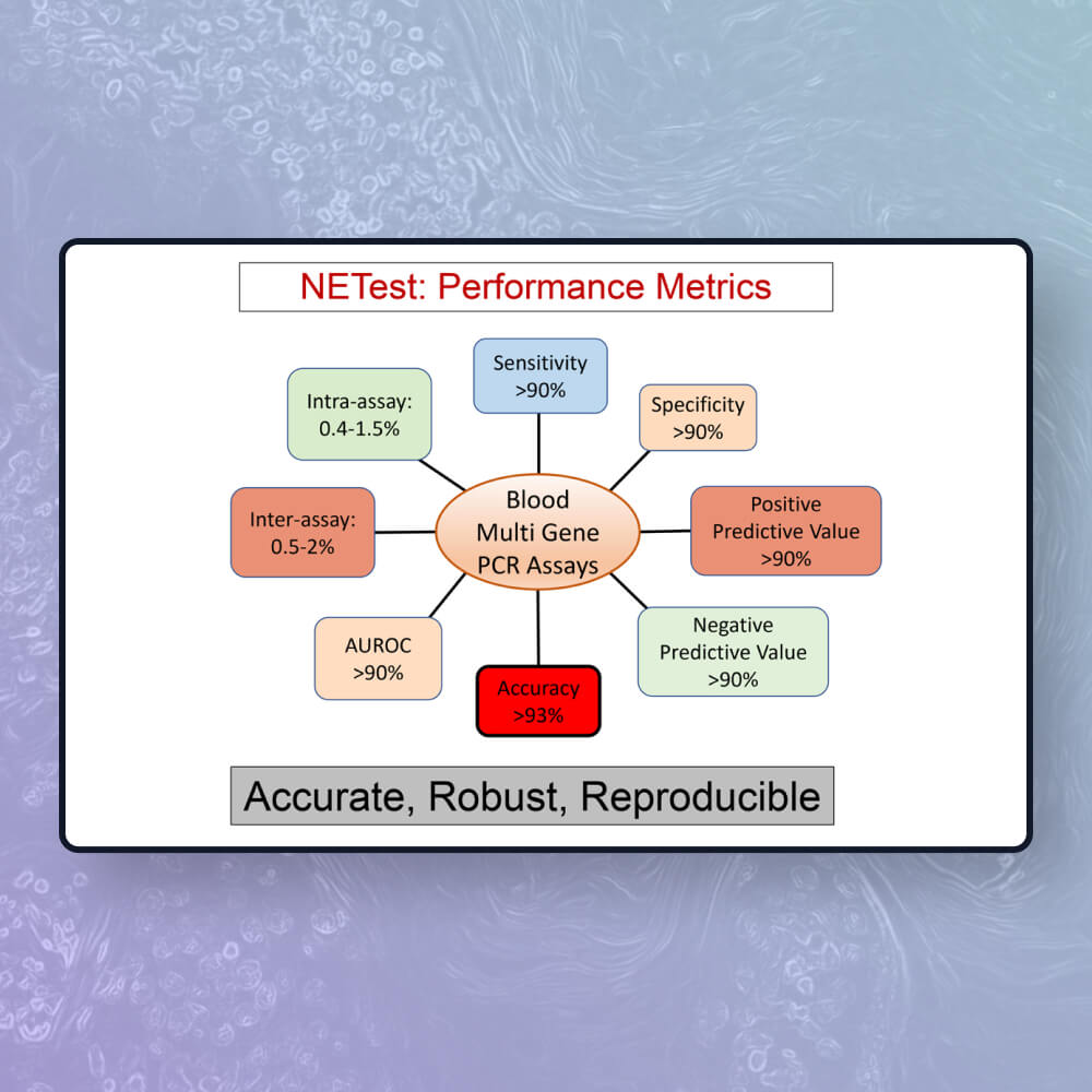 NETest performance metrics chart: Accurate, Robust and Reproducible.